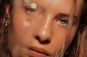 Botox op derde oog